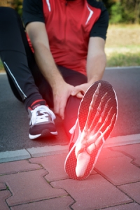 All About Stress Fractures