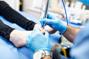 How Laser Treatment Works to Kill Toenail Fungus