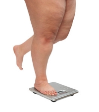 How Increased Weight May Affect the Feet