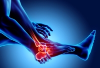 Difference Between Foot Arthritis and Foot Arthralgia