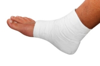 How to Tell the Difference Between a Broken Bone and a Sprain