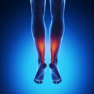 Achilles Tendinitis Could Be the Cause of Your Ankle Pain