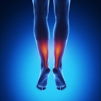 Achilles Tendinitis Could Be the Cause of Your Ankle Pain